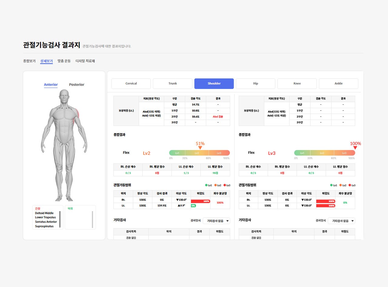 좌우 관절 가동범위와 근육 균형, 위험도가 정리된 4DEYE 검사 결과지 화면